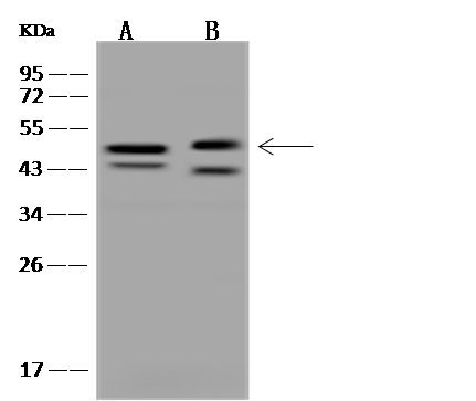 Western Blot: CBWD1 Antibody - BSA Free [NBP3-05877] - NBP3-05877 at 1:500 dilution Lane A: U-251MG Whole Cell Lysate Lane B: U-87 MG Whole Cell Lysate Lysates/proteins at 30 ug per lane. Secondary Goat Anti-Rabbit IgG (H+L)/HRP at 1/10000 dilution. Developed using the ECL technique. Performed under reducing conditions. Predicted band size:44 kDa Observed band size:44 kDa (We are unsure as to the identity of these extra bands.) 