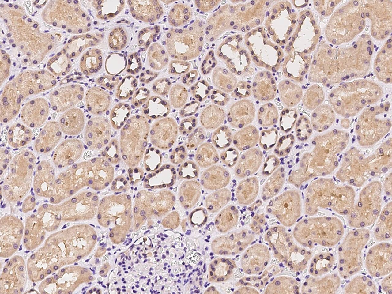 Immunohistochemistry-Paraffin: CBWD1 Antibody - BSA Free [NBP3-05877] - Immunochemical staining of human CBWD1 in human kidney with NBP3-05877 at 1:100 dilution, formalin-fixed paraffin embedded sections.