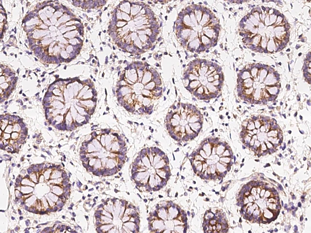 Immunohistochemistry-Paraffin: CCDC66 Antibody - BSA Free [NBP3-05878] - Immunochemical staining of human CCDC66 in human rectum with NBP3-05878 at 1:100 dilution, formalin-fixed paraffin embedded sections.