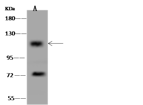 Western Blot: CCDC66 Antibody - BSA Free [NBP3-05878] - NBP3-05878 at 1:500 dilution Lane A: U-251MG Whole Cell Lysate Lysates/proteins at 30 ug per lane. Secondary Goat Anti-Rabbit IgG (H+L)/HRP at 1/10000 dilution. Developed using the ECL technique. Performed under reducing conditions. Predicted band size:109 kDa Observed band size:109 kDa (We are unsure as to the identity of these extra bands.) 