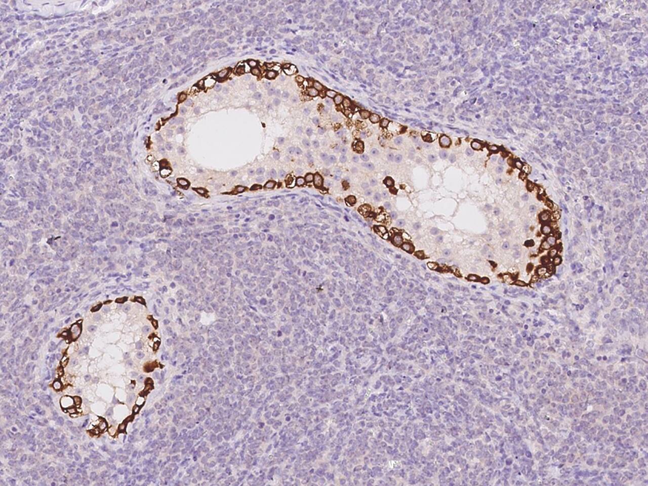 Immunohistochemistry-Paraffin: STK31 Antibody - BSA Free [NBP3-05887] - Immunochemical staining of human STK31 in human testis with NBP3-05887 at 1:500 dilution, formalin-fixed paraffin embedded sections.