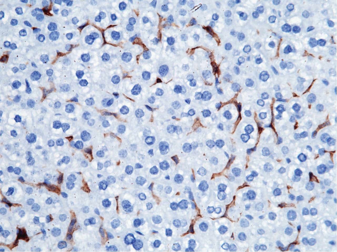 Immunohistochemistry-Paraffin: FcgR4/CD16-2 Antibody (011) [NBP3-05889] - Immunochemical staining of FcgR4/CD16-2 in mouse liver with NBP3-05889 (1:200, formalin-fixed paraffin embedded sections).