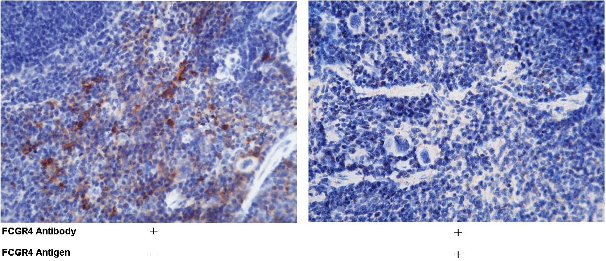 Immunohistochemistry-Paraffin: FcgR4/CD16-2 Antibody (011) [NBP3-05889] - Immunochemical staining of FcgR4/CD16-2 in mouse spleen with NBP3-05889 (1:200, formalin-fixed paraffin embedded sections). The left panel: tissue incubated with primary antibody; The right panel: tissue incubated with the mixture of primary antibody and antigen (recombinant protein).