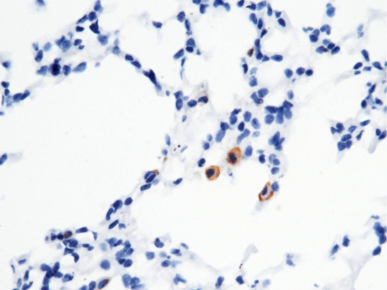Immunohistochemistry-Paraffin: FcgR4/CD16-2 Antibody (011) [NBP3-05889] - Immunochemical staining of FcgR4/CD16-2 in mouse lung with NBP3-05889 (1:200, formalin-fixed paraffin embedded sections).Positive staining was localized to pulmonary macrophage.