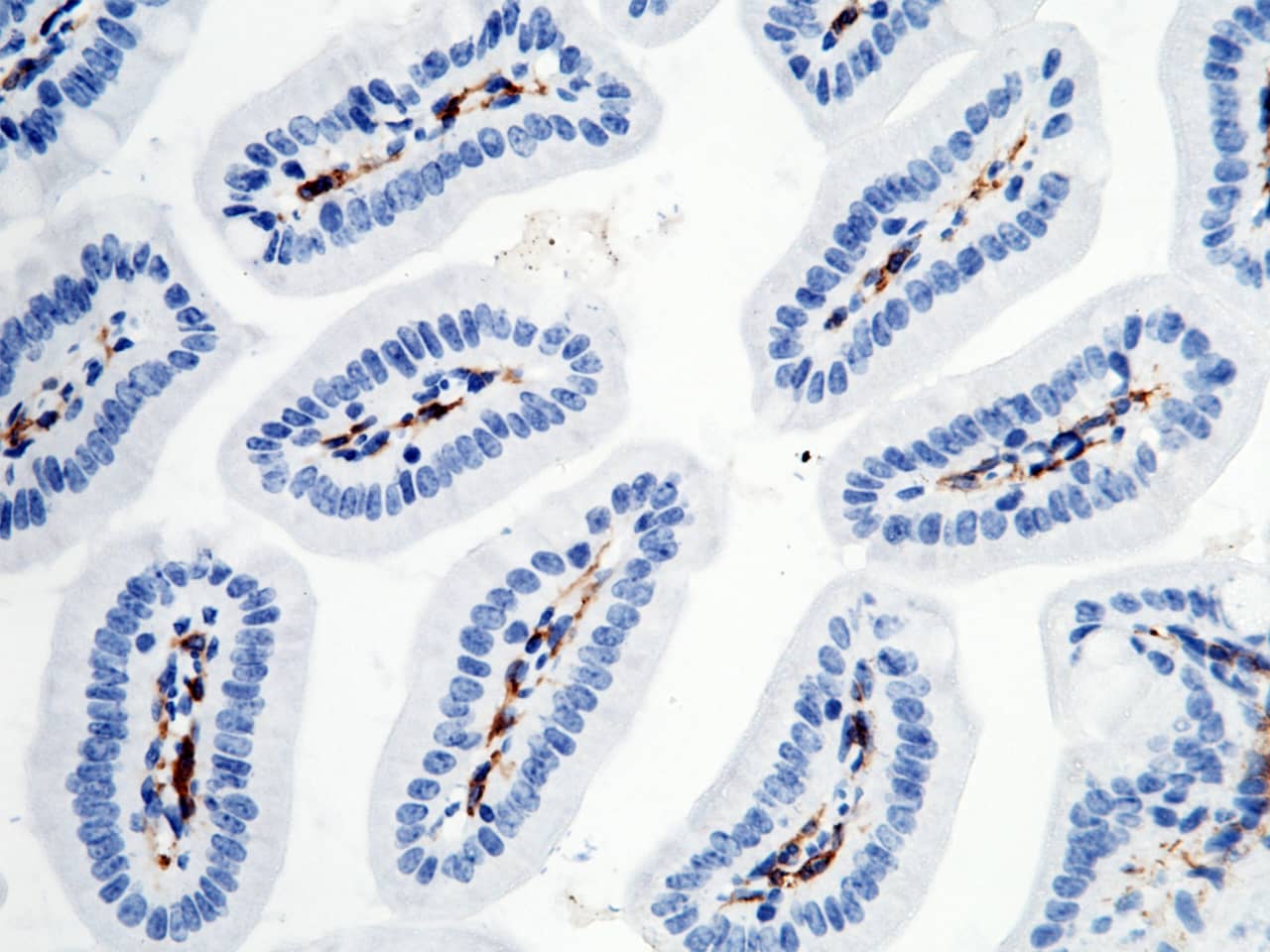 Immunohistochemistry-Paraffin: FcgR4/CD16-2 Antibody (011) [NBP3-05889] - Immunochemical staining of FcgR4/CD16-2 in mouse intestine with NBP3-05889 (1:200, formalin-fixed paraffin embedded sections).