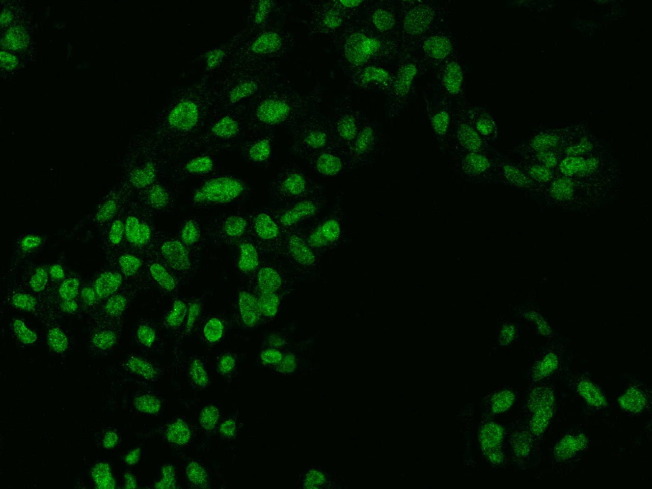 Immunocytochemistry/Immunofluorescence: ZKSCAN2 Antibody [NBP3-05894] - Staining of ZKSCAN2 in HepG2 cells. Cells were fixed with 4% PFA, permeabilzed with 0.3% Triton X-100 in PBS,blocked with 10% serum, and incubated with NBP3-05894 antibody (dilution ratio 1:200) at 4? overnight. Then cells were stained with the Alexa Fluor488-conjugated Goat Anti-rabbit IgG secondary antibody (green). Positive staining was localized to Nucleus.