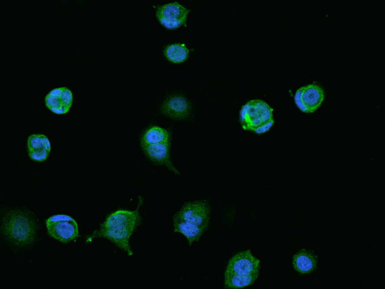 Immunocytochemistry/Immunofluorescence: CCDC9 Antibody [NBP3-05897] - Staining of CCDC9 in MCF7 cells. Cells were fixed with 4% PFA, permeabilzed with 0.1% Triton X-100 in PBS,blocked with 10% serum, and incubated with NBP3-05897 antibody (dilution ratio 1:200) at 4? overnight. Then cells were stained with the Alexa Fluor488-conjugated Goat Anti-rabbit IgG secondary antibody (green) and counterstained with DAPI (blue).Positive staining was localized to Cytoplasm