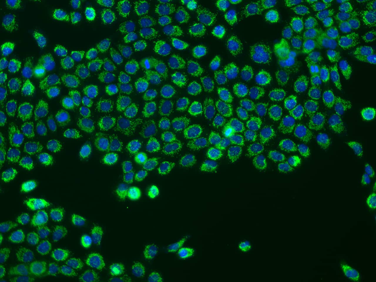 Immunocytochemistry/Immunofluorescence: CHCHD10 Antibody [NBP3-05898] -  Staining of CHCHD10 in A431 cells. Cells were fixed with 4% PFA, permeabilzed with 0.1% Triton X-100 in PBS,blocked with 10% serum, and incubated with NBP3-05898 antibody (dilution ratio 1:200) at 4? overnight. Then cells were stained with the Alexa Fluor488-conjugated Goat Anti-rabbit IgG secondary antibody (green) and counterstained with DAPI (blue).Positive staining was localized to Cytoplasm.