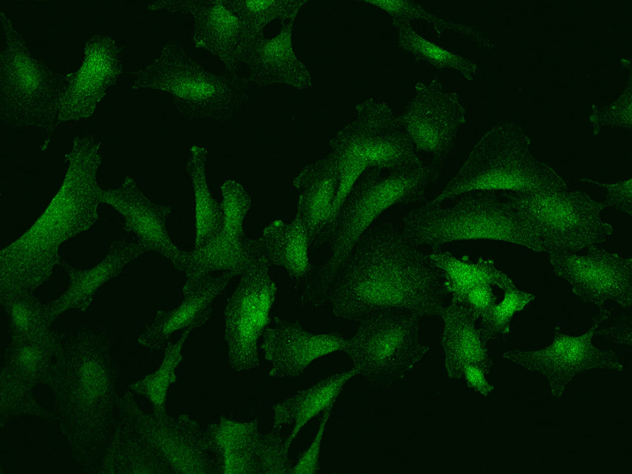 Immunocytochemistry/Immunofluorescence: SGEF Antibody [NBP3-05912] - Staining of SGEF in U251MG cells. Cells were fixed with 4% PFA, permeabilzed with 0.1% Triton X-100 in PBS,blocked with 10% serum, and incubated with NBP3-05912 antibody (dilution ratio 1:200) at 4? overnight. Then cells were stained with the Alexa Fluor488-conjugated Goat Anti-rabbit IgG secondary antibody (green). Positive staining was localized to Nucleus ? Cytoplasm and Cell membrane.