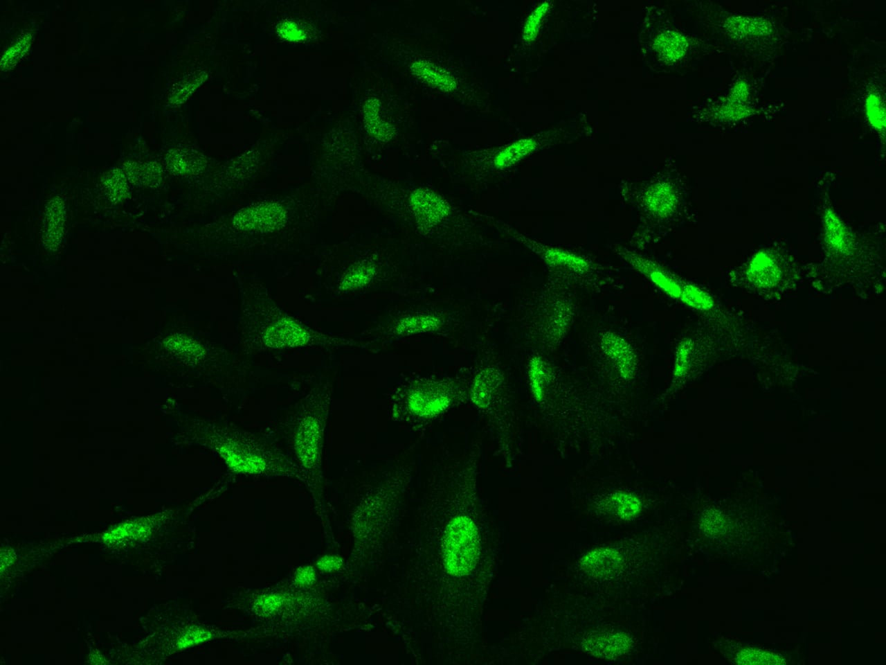 Immunocytochemistry/Immunofluorescence: Phospholipase C delta 1 Antibody [NBP3-05935] - Staining of PLCD1 in U251MG cells. Cells were fixed with 4% PFA, permeabilzed with 0.1% Triton X-100 in PBS,blocked with 10% serum, and incubated with NBP3-05935 antibody (dilution ratio 1:200) at 4? overnight. Then cells were stained with the Alexa Fluor488-conjugated Goat Anti-rabbit IgG secondary antibody (green). Positive staining was localized to Nucleus.