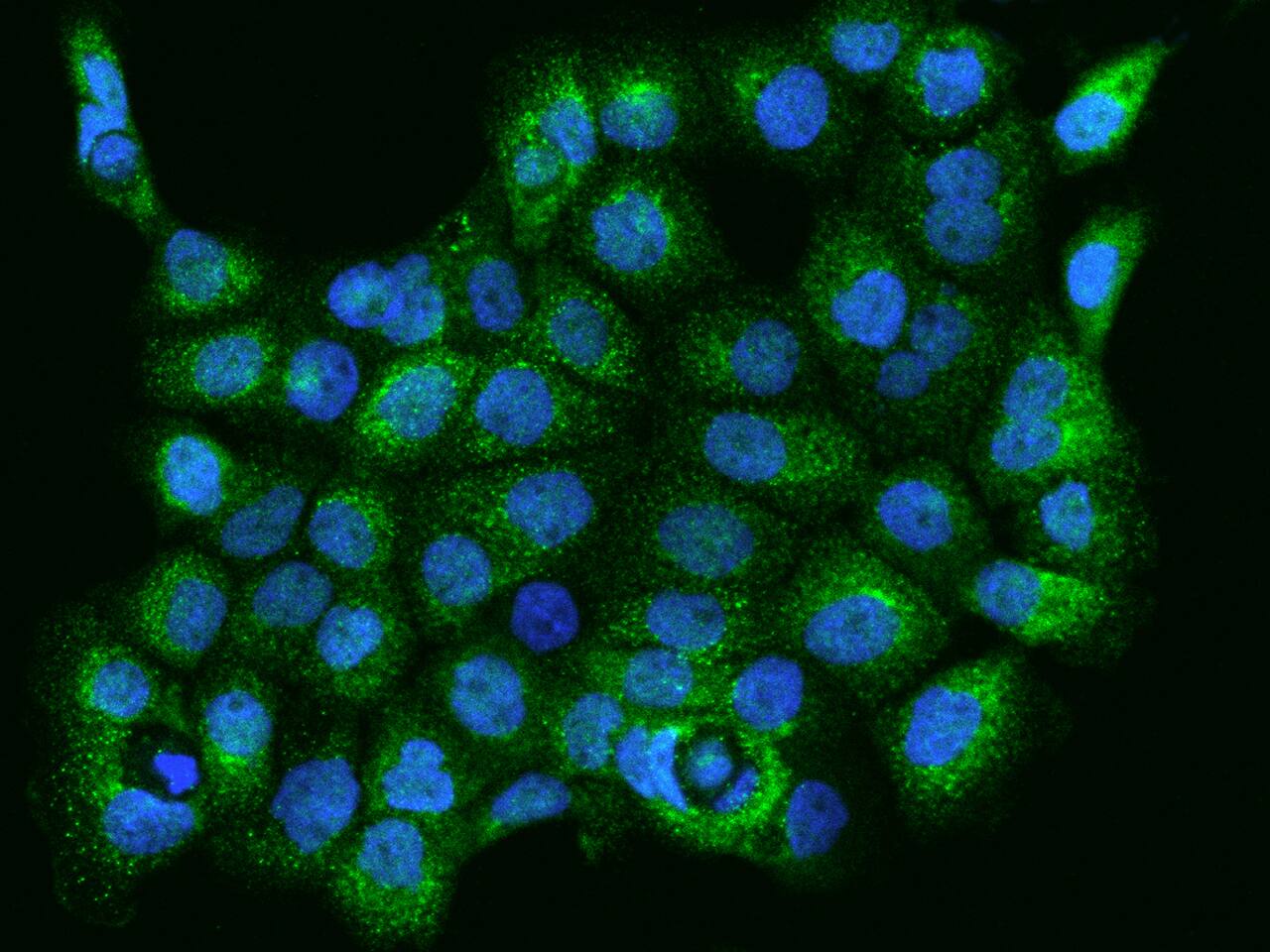 Immunocytochemistry/Immunofluorescence: XK X-linked Kx blood group Antibody [NBP3-05963] - Staining of XK in A431 cells. Cells were fixed with 4% PFA, permeabilzed with 0.1% Triton X-100 in PBS,blocked with 10% serum, and incubated with NBP3-05963 antibody (dilution ratio 1:200) at 4? overnight. Then cells were stained with the Alexa Fluor488-conjugated Goat Anti-rabbit IgG secondary antibody (green) and counterstained with DAPI (blue).Positive staining was localized to Cytoplasm.
