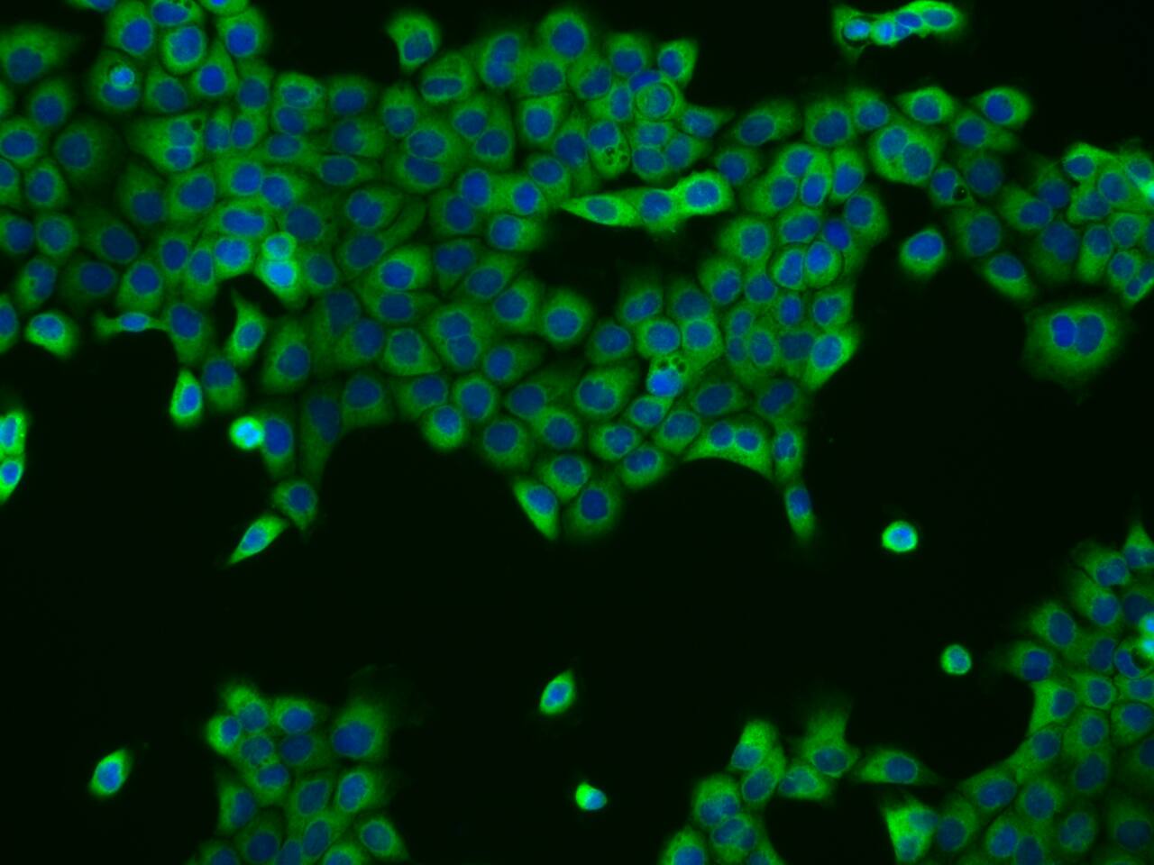 Immunocytochemistry/ Immunofluorescence UBXD2 Antibody - BSA Free