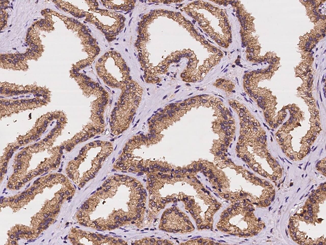 Immunohistochemistry-Paraffin: STX17 Antibody - BSA Free [NBP3-05995] - Immunochemical staining of human STX17 in human prostate with NBP3-05995 at 1:500 dilution, formalin-fixed paraffin embedded sections.