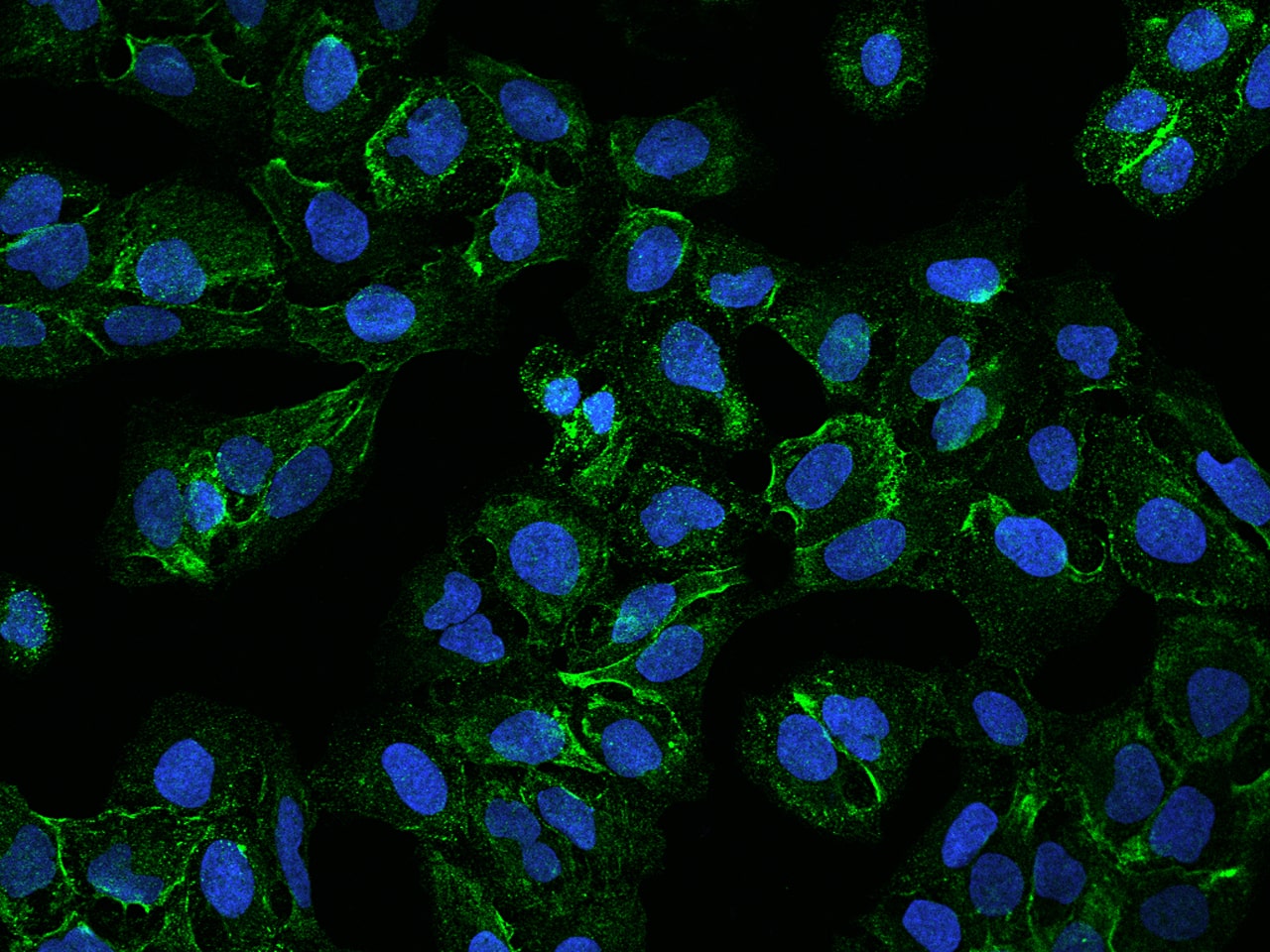 Immunocytochemistry/Immunofluorescence: FAM198A Antibody [NBP3-06029] - Immunofluorescence staining of FAM198A in U2OS cells. Cells were fixed with 4% PFA, permeabilzed with 0.3% Triton X-100 in PBS, blocked with 10% serum, and incubated with NBP3-06029 antibody (dilution ratio 1:200) at  4 degrees celsius overnight. Then cells were stained with the Alexa Fluor (TM) 488-conjugated Goat Anti-rabbit IgG secondary antibody (green) and counterstained with DAPI (blue). Positive staining was localized to Cytoplasm.