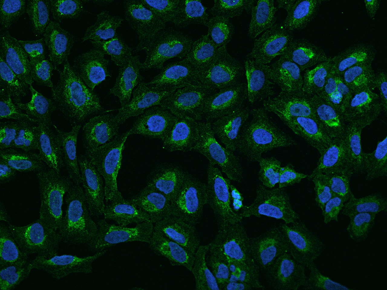 Immunocytochemistry/Immunofluorescence: MRPS2 Antibody [NBP3-06045] - Immunofluorescence staining of MRPS2 in U2OS cells. Cells were fixed with 4% PFA, permeabilzed with 0.1% Triton X-100 in PBS,blocked with 10% serum, and incubated with NBP3-06045 antibody (dilution ratio 1:200) at 4C overnight. Then cells were stained with the Alexa Fluor(R)488-conjugated Goat Anti-rabbit IgG secondary antibody (green) and counterstained with DAPI (blue).Positive staining was localized to Cytoplasm.