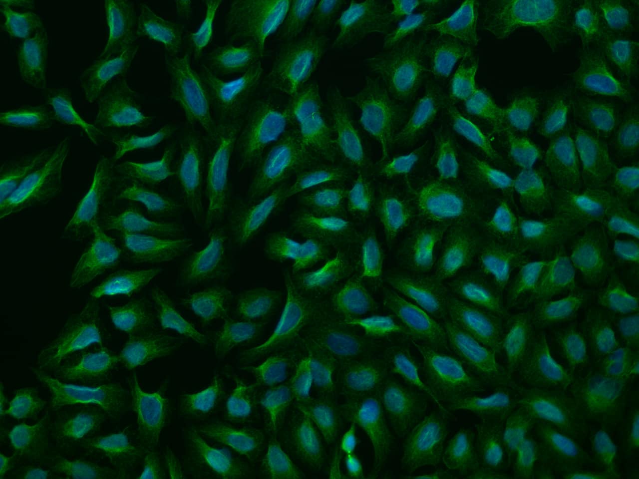 Immunocytochemistry/Immunofluorescence: HKR2 Antibody [NBP3-06056] - Immunofluorescence staining of HKR2 in U2OS cells. Cells were fixed with 4% PFA, permeabilzed with 0.1% Triton X-100 in PBS,blocked with 10% serum, and incubated with NBP3-06056 antibody (dilution ratio 1:200) at  4 degrees celsius overnight. Then cells were stained with the Alexa Fluor (TM) 488-conjugated Goat Anti-rabbit IgG secondary antibody (green) and counterstained with DAPI (blue).Positive staining was localized to Cytoplasm.