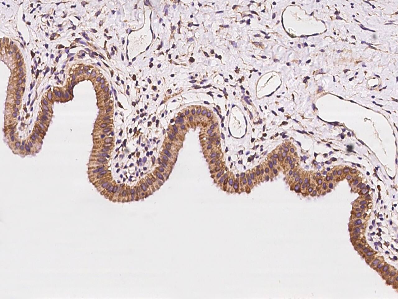 Immunohistochemistry-Paraffin: CLCC1 Antibody - BSA Free [NBP3-06071] - Immunochemical staining of human CLCC1 in human gallbladder with NBP3-06071 at 1:100 dilution, formalin-fixed paraffin embedded sections.