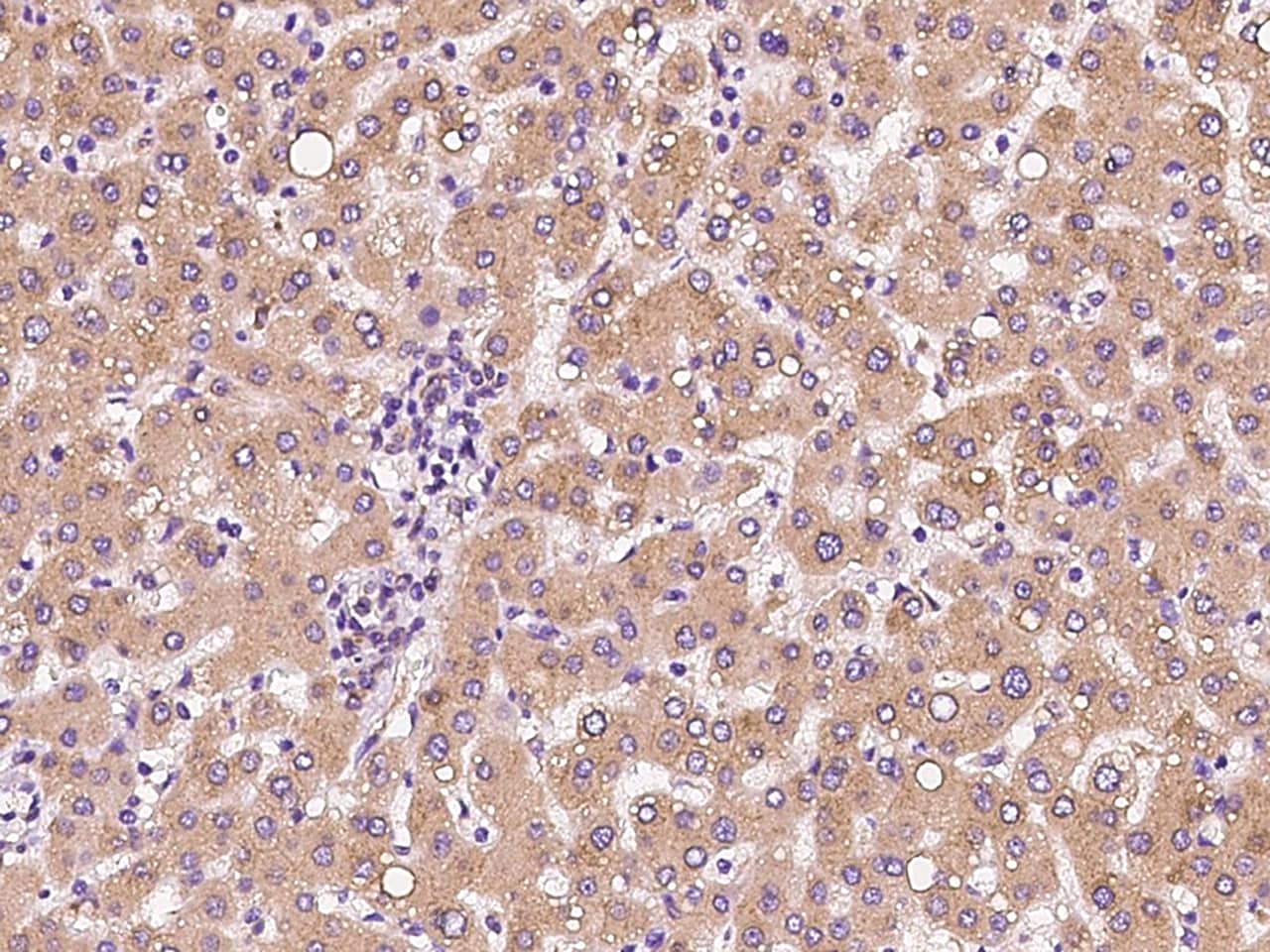 Immunohistochemistry-Paraffin: CLCC1 Antibody - BSA Free [NBP3-06071] - Immunochemical staining of human CLCC1 in human liver with NBP3-06071 at 1:100 dilution, formalin-fixed paraffin embedded sections.