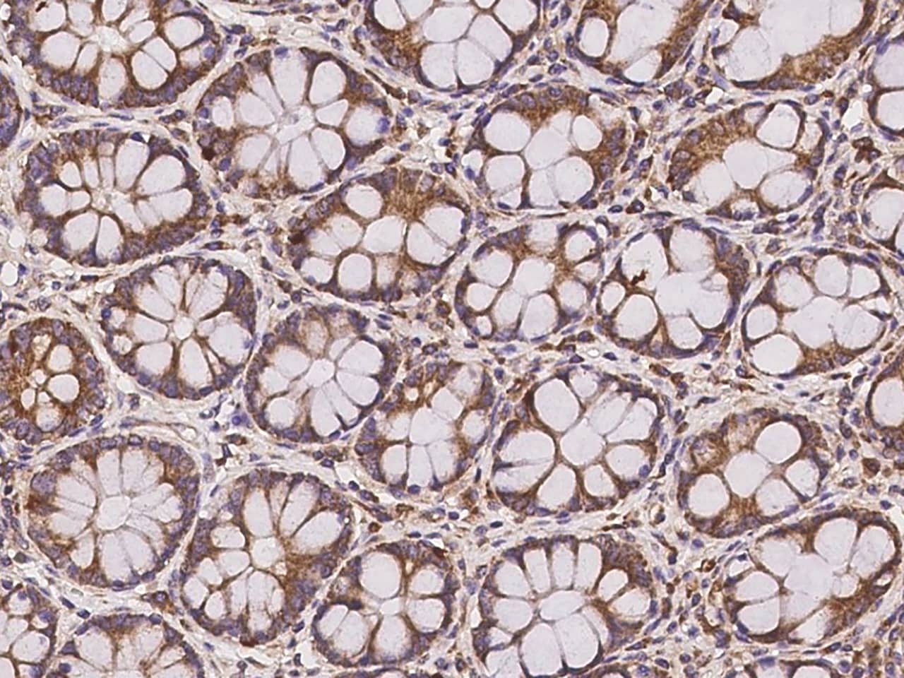 Immunohistochemistry-Paraffin: CLUAP1 Antibody - BSA Free [NBP3-06085] - Immunochemical staining of human CLUAP1 in human rectum with NBP3-06085 at 1:500 dilution, formalin-fixed paraffin embedded sections.