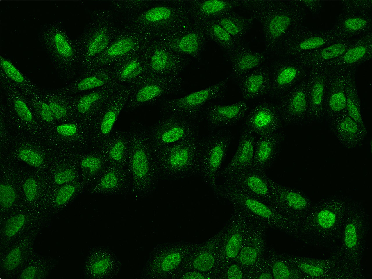 Immunocytochemistry/Immunofluorescence: SPATA31E1 Antibody [NBP3-06105] - Immunofluorescence staining of SPATA31E1  in U2OS cells. Cells were fixed with 4% PFA, permeabilzed with 0.1% Triton X-100 in PBS, blocked with 10% serum, and incubated with NBP3-06105 (dilution ratio 1:100) at  4 degrees celsius overnight. Then cells were stained with the Alexa Fluor (TM) 488-conjugated Goat Anti-rabbit IgG secondary antibody (green). Positive staining was localized to Nucleus and Cytoplasm.