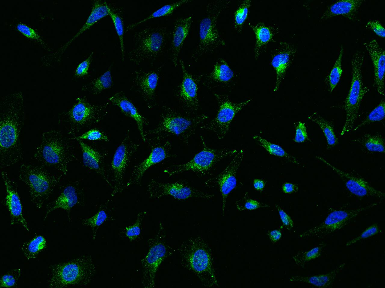 Immunocytochemistry/Immunofluorescence: SPPL2a Antibody [NBP3-06160] - Immunofluorescence staining of SPPL2A in HeLa cells. Cells were fixed with 4% PFA, permeabilzed with 0.3% Triton X-100 in PBS,blocked with 10% serum, and incubated with NBP3-06160 antibody (dilution ratio 1:200) at  4 degrees celsius overnight. Then cells were stained with the Alexa Fluor (TM) 488-conjugated Goat Anti-rabbit IgG secondary antibody (green) and counterstained with DAPI (blue).Positive staining was localized to Cytoplasm.