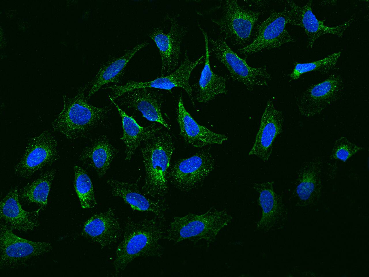 Immunocytochemistry/Immunofluorescence: NBPF15 Antibody [NBP3-06172] - Immunofluorescence staining of NBPF15 in U2OS cells. Cells were fixed with 4% PFA, permeabilzed with 0.3% Triton X-100 in PBS,blocked with 10% serum, and incubated with NBP3-06172 antibody (dilution ratio 1:200) at  4 degrees celsius overnight. Then cells were stained with the Alexa Fluor (TM) 488-conjugated Goat Anti-rabbit IgG secondary antibody (green) and counterstained with DAPI (blue).Positive staining was localized to Cytoplasm.