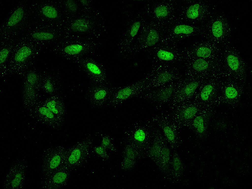 Immunocytochemistry/Immunofluorescence: LAF4 Antibody [NBP3-06186] - Staining of AFF3 in U2OS cells. Cells were fixed with 4% PFA, permeabilzed with 0.1% Triton X-100 in PBS,blocked with 10% serum, and incubated with NBP3-06186 antibody (dilution ratio 1:200) at 4? overnight. Then cells were stained with the Alexa Fluor488-conjugated Goat Anti-rabbit IgG secondary antibody (green). Positive staining was localized to Nucleus.