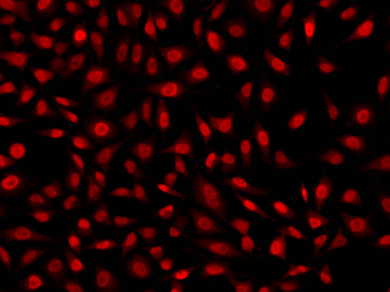 Immunocytochemistry/ Immunofluorescence KLF6 Antibody - BSA Free