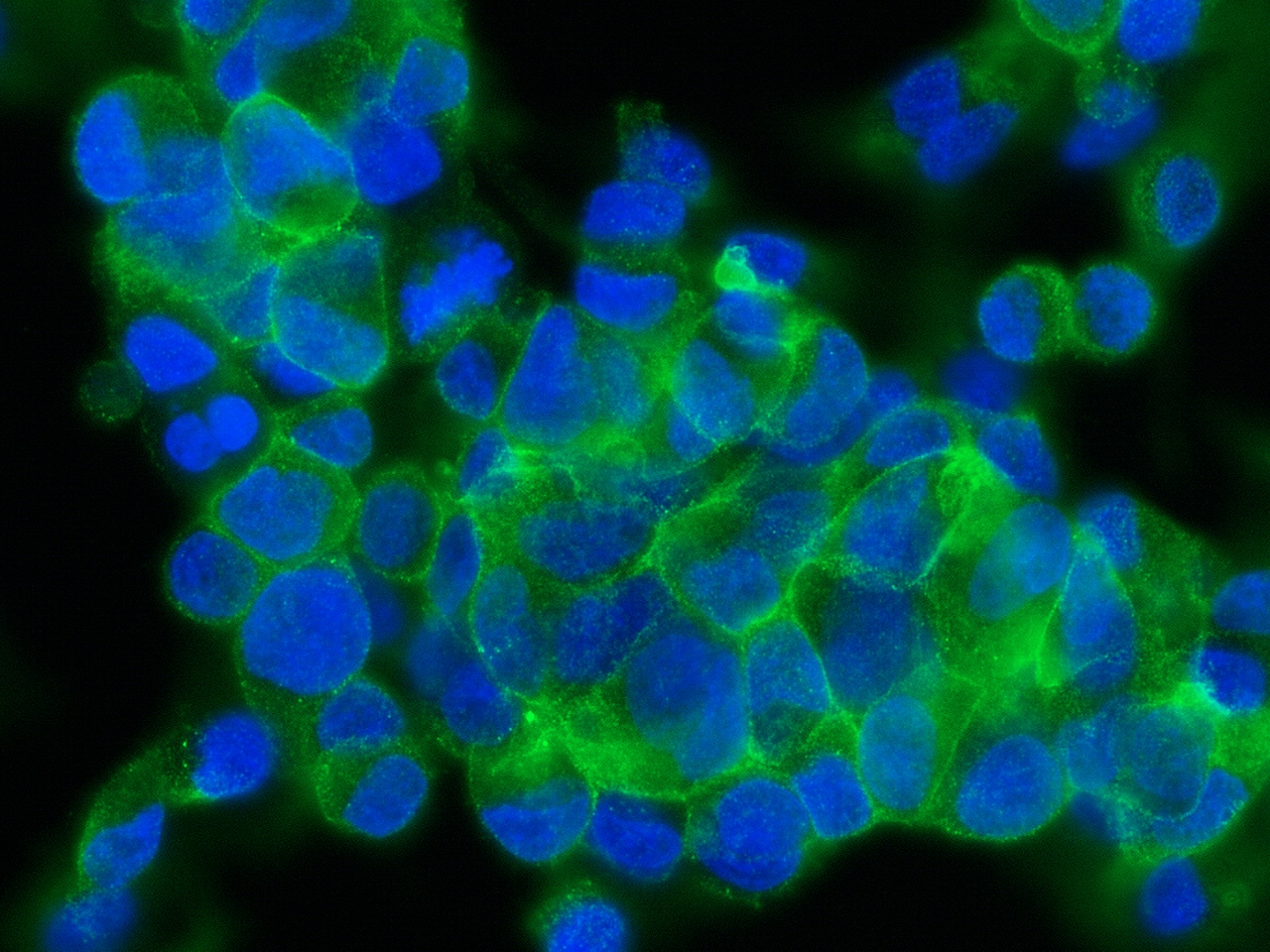 Immunocytochemistry/Immunofluorescence: Asialoglycoprotein Receptor 2 Antibody (002) [NBP3-06211] - Immunofluorescence staining of ASGR2 in HepG2 cells. Cells were fixed with 4% PFA, permeabilzed with 0.3% Triton X-100 in PBS, blocked with 10% serum, and incubated with NBP3-06211 antibody (1:60) at 4 degrees celsius overnight. Then cells were stained with the Alexa Fluor (TM) 488-conjugated Goat Anti-rabbit IgG secondary antibody (green) and counterstained with DAPI (blue).