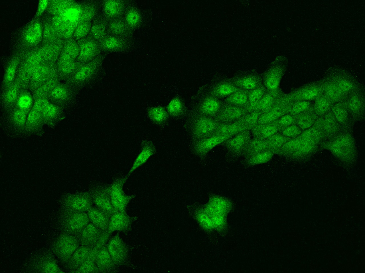 Immunocytochemistry/Immunofluorescence: ZNF543 Antibody [NBP3-06246] - Immunofluorescence staining of ZNF543 in A431 cells. Cells were fixed with 4% PFA, permeabilzed with 0.3% Triton X-100 in PBS,blocked with 10% serum, and incubated with NBP3-06246 antibody (dilution ratio 1:100) at 4 degrees celsius overnight. Then cells were stained with the Alexa Fluor (TM) 488-conjugated Goat Anti-rabbit IgG secondary antibody (green). Positive staining was localized to Nucleus and Cytoplasm.