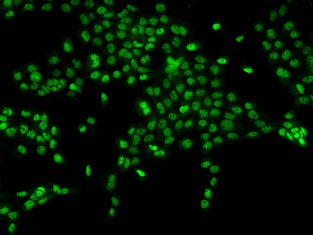 Immunocytochemistry/Immunofluorescence: MORC3 Antibody [NBP3-06255] - Immunofluorescence staining of MORC3 in A431 cells. Cells were fixed with 4% PFA, permeabilzed with 0.1% Triton X-100 in PBS,blocked with 10% serum, and incubated with NBP3-06255 antibody (dilution ratio 1:200) at 4 degrees celcius overnight. Then cells were stained with the Alexa Fluor (TM) 488-conjugated Goat Anti-rabbit IgG secondary antibody (green). Positive staining was localized to Nucleus.