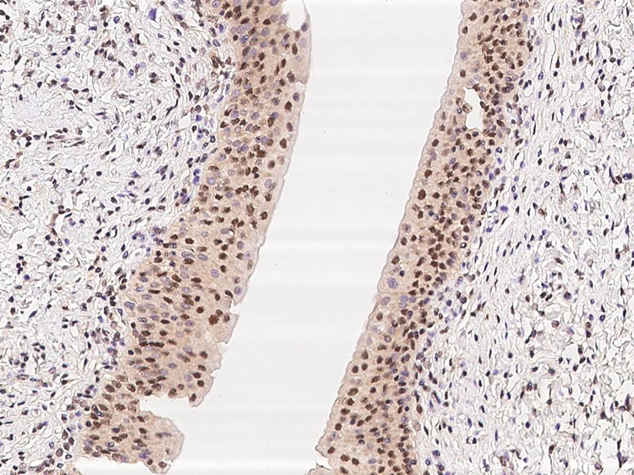 Immunohistochemistry-Paraffin: C7orf25 Antibody - BSA Free [NBP3-06256] - Immunochemical staining of human C7orf25 in human urinary bladder with NBP3-06256 at 1:100 dilution, formalin-fixed paraffin embedded sections.