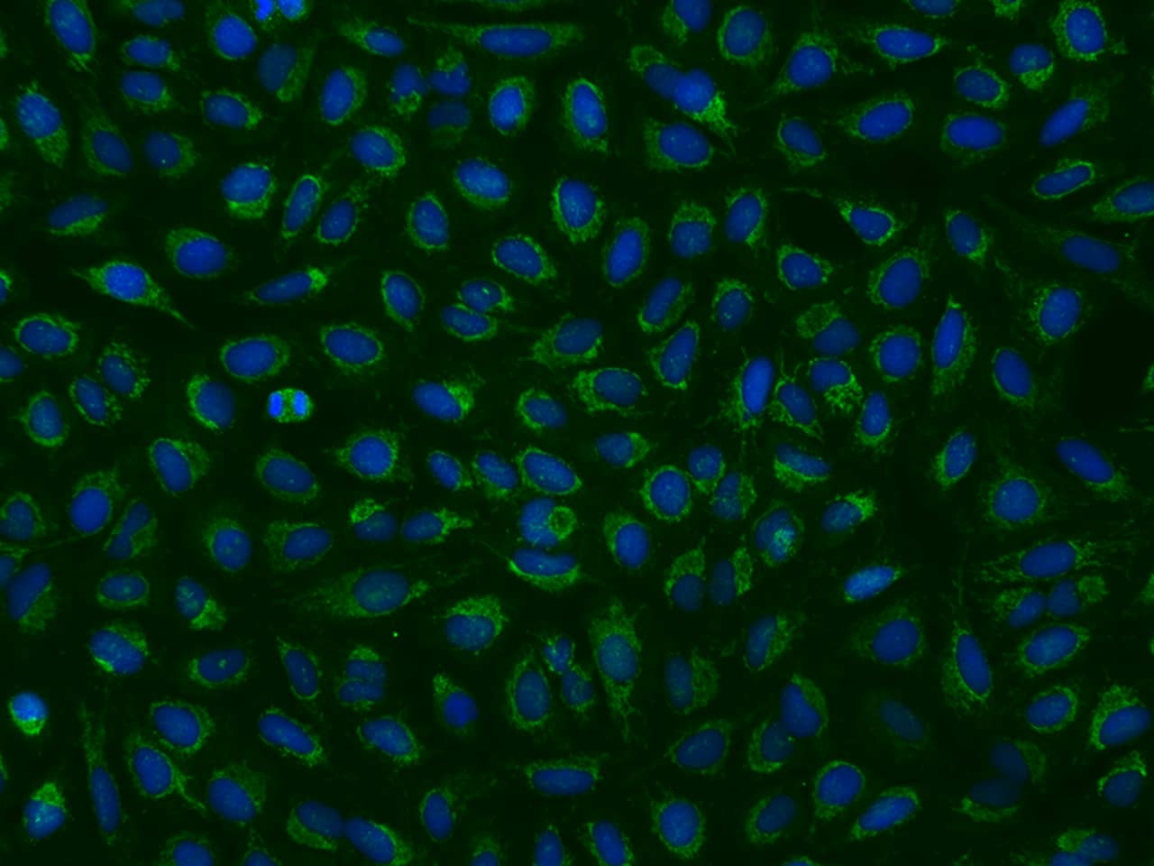 Immunocytochemistry/Immunofluorescence: MRPL9 Antibody [NBP3-06270] - Immunofluorescence staining of MRPL9 in U2OS cells. Cells were fixed with 4% PFA, permeabilzed with 0.1% Triton X-100 in PBS,blocked with 10% serum, and incubated with NBP3-06270 antibody (dilution ratio 1:200) at 4 degrees celsius overnight. Then cells were stained with the Alexa Fluor (TM) 488-conjugated Goat Anti-rabbit IgG secondary antibody (green) and counterstained with DAPI (blue).Positive staining was localized to Cytoplasm.