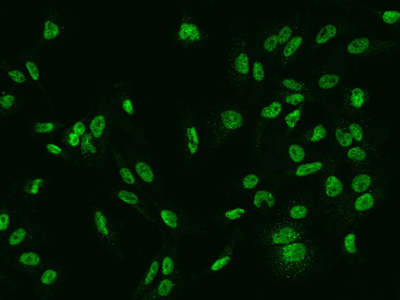 Immunocytochemistry/ Immunofluorescence SLCO4C1 Antibody - BSA Free