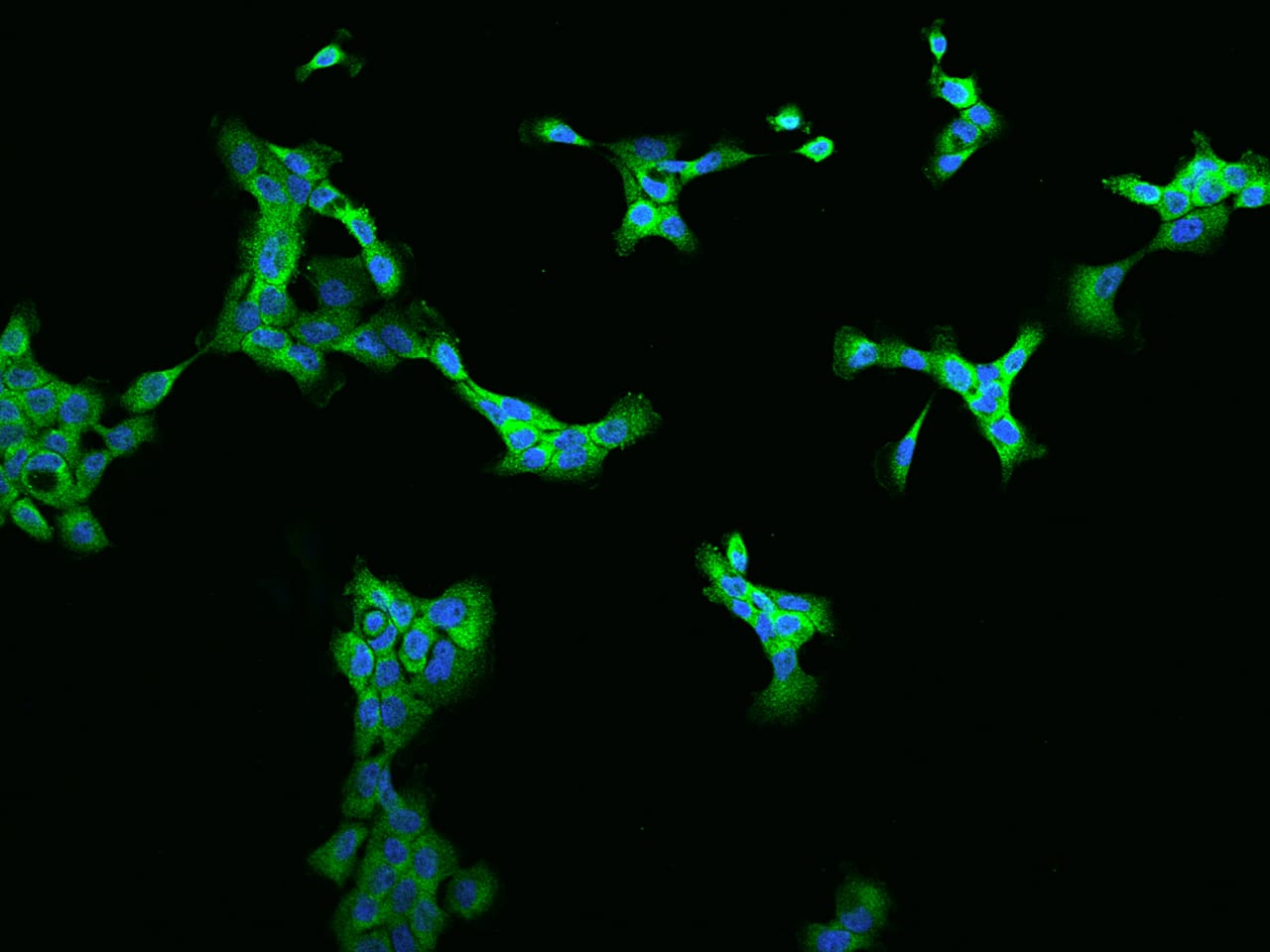 Immunocytochemistry/Immunofluorescence: ZC3H7A Antibody [NBP3-06301] - Immunofluorescence staining of ZC3H7A in A431 cells. Cells were fixed with 4% PFA, permeabilzed with 0.1% Triton X-100 in PBS,blocked with 10% serum, and incubated with NBP3-06301 antibody (dilution ratio 1:200) at 4 degrees celsius overnight. Then cells were stained with the Alexa Fluor (TM) 488-conjugated Goat Anti-rabbit IgG secondary antibody (green) and counterstained with DAPI (blue).Positive staining was localized to Cytoplasm.