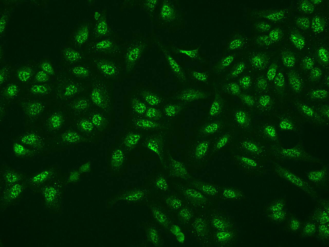 Immunocytochemistry/Immunofluorescence: EI2BL Antibody [NBP3-06310] - Immunofluorescence staining of EI2BL in U2OS cells. Cells were fixed with 4% PFA, permeabilzed with 0.1% Triton X-100 in PBS, blocked with 10% serum, and incubated with NBP3-06310 (dilution ratio 1:200) at  4 degrees celsius overnight. Then cells were stained with the Alexa Fluor (TM) 488-conjugated Goat Anti-rabbit IgG secondary antibody (green). Positive staining was localized to Nucleus and Cytoplasm.