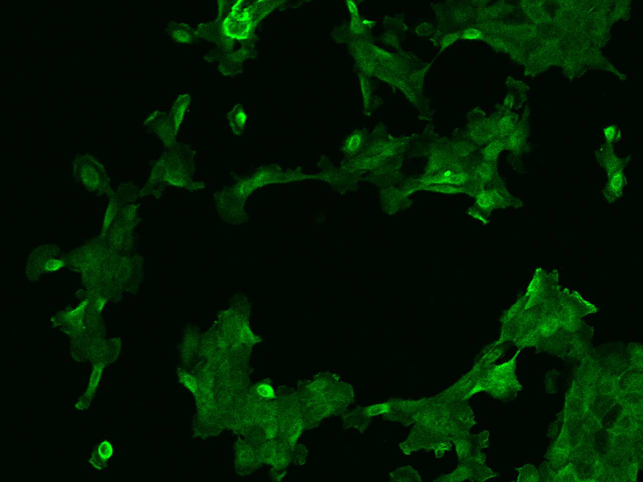 Immunocytochemistry/Immunofluorescence: AFAP1L2 Antibody [NBP3-06316] - Immunofluorescence staining of AFAP1L2 in A431 cells. Cells were fixed with 4% PFA, permeabilzed with 0.1% Triton X-100 in PBS,blocked with 10% serum, and incubated with NBP3-06316 antibody (dilution ratio 1:200) at 4 degrees celsius overnight. Then cells were stained with the Alexa Fluor (TM) 488-conjugated Goat Anti-rabbit IgG secondary antibody (green) and counterstained with DAPI (blue).Positive staining was localized to Cytoplasm and cell membrane.