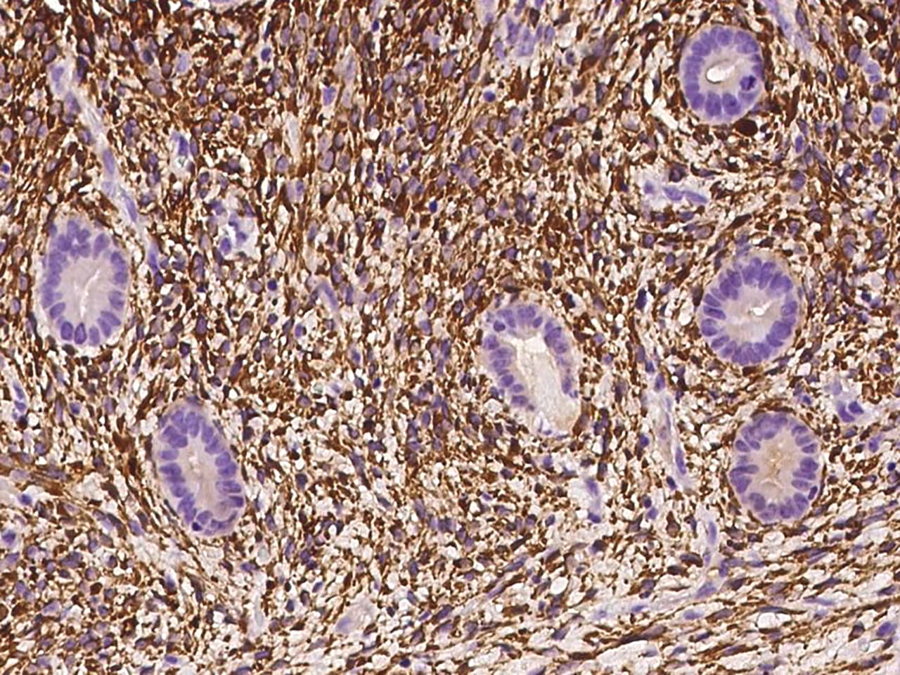 Immunohistochemistry-Paraffin: ALDH1A2 Antibody - BSA Free [NBP3-06323] - Immunochemical staining of human ALDH1A2 in human corpus uteri with NBP3-06323 at 1:100 dilution, formalin-fixed paraffin embedded sections.
