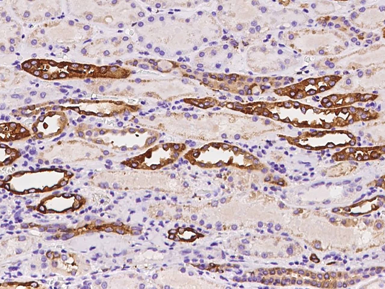 Immunohistochemistry-Paraffin: ALDH1A2 Antibody - BSA Free [NBP3-06323] - Immunochemical staining of human ALDH1A2 in human kidney with NBP3-06323 at 1:100 dilution, formalin-fixed paraffin embedded sections.