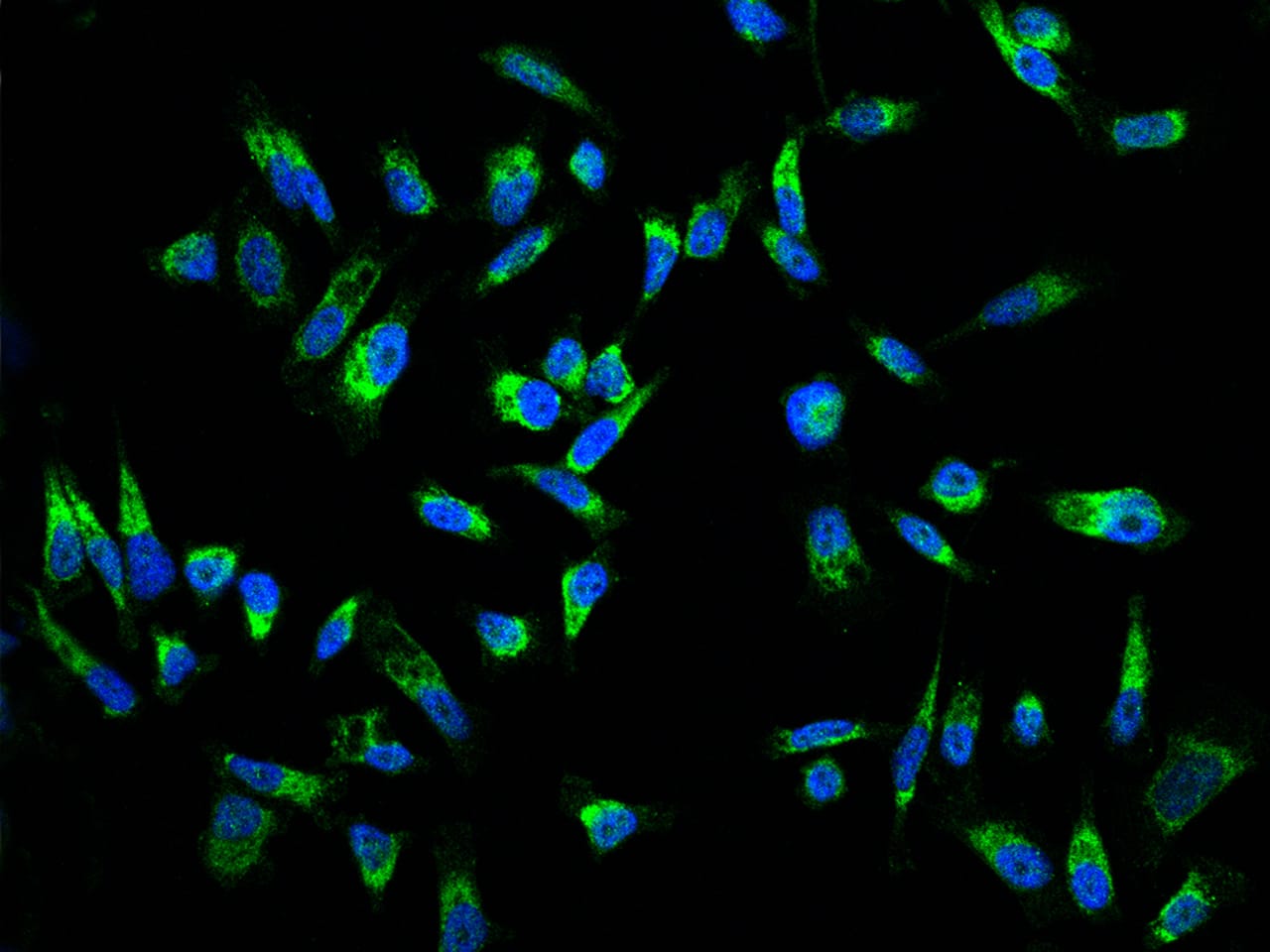 Immunocytochemistry/Immunofluorescence: MRPL23 Antibody [NBP3-06349] - Immunofluorescence staining of MRPL23 in PC3 cells. Cells were fixed with 4% PFA, permeabilzed with 0.3% Triton X-100 in PBS,blocked with 10% serum, and incubated with NBP3-06349 antibody (dilution ratio 1:200) at 4 degrees celsius overnight. Then cells were stained with the Alexa Fluor (TM) 488-conjugated Goat Anti-rabbit IgG secondary antibody (green) and counterstained with DAPI (blue).Positive staining was localized to Cytoplasm.