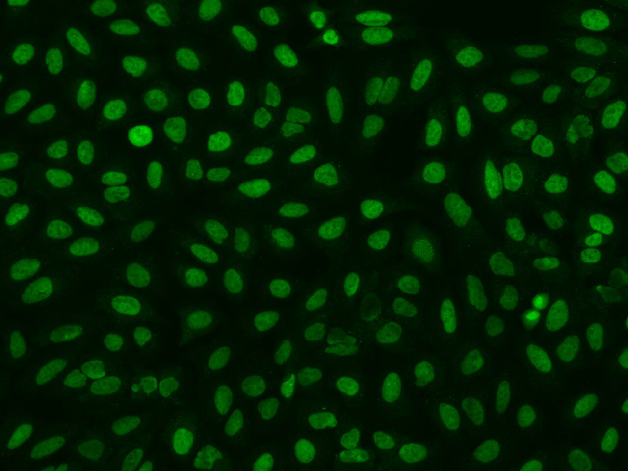 Immunocytochemistry/Immunofluorescence: HCA59 Antibody [NBP3-06357] - Immunofluorescence staining of HCA59 in U2OS cells. Cells were fixed with 4% PFA, permeabilzed with 0.1% Triton X-100 in PBS,blocked with 10% serum, and incubated with NBP3-06357 antibody (dilution ratio 1:200) at 4C overnight. Then cells were stained with the Alexa Fluor(R)488-conjugated Goat Anti-rabbit IgG secondary antibody (green). Positive staining was localized to Nucleus.