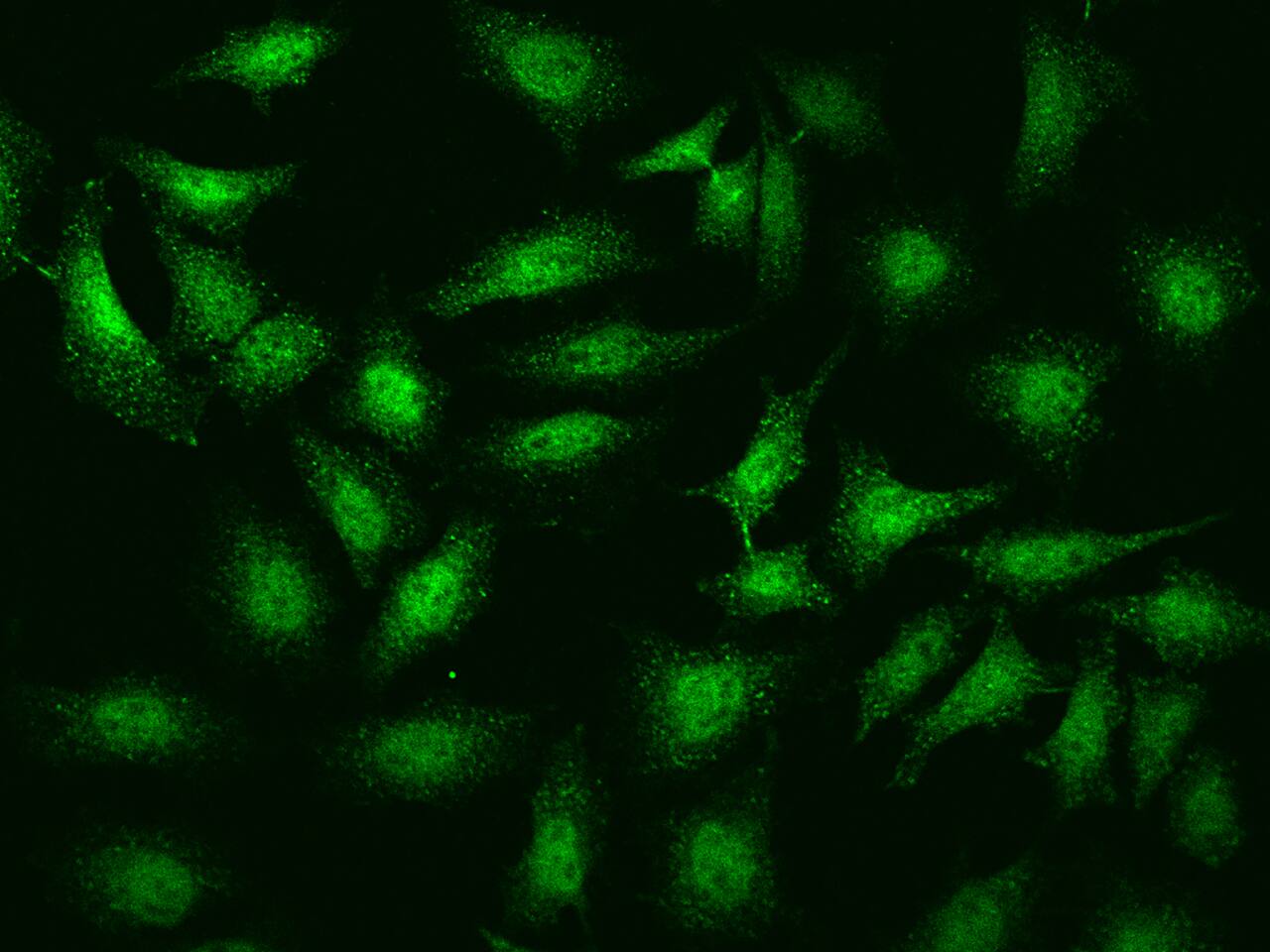 Immunocytochemistry/ Immunofluorescence CaMKV Antibody - BSA Free