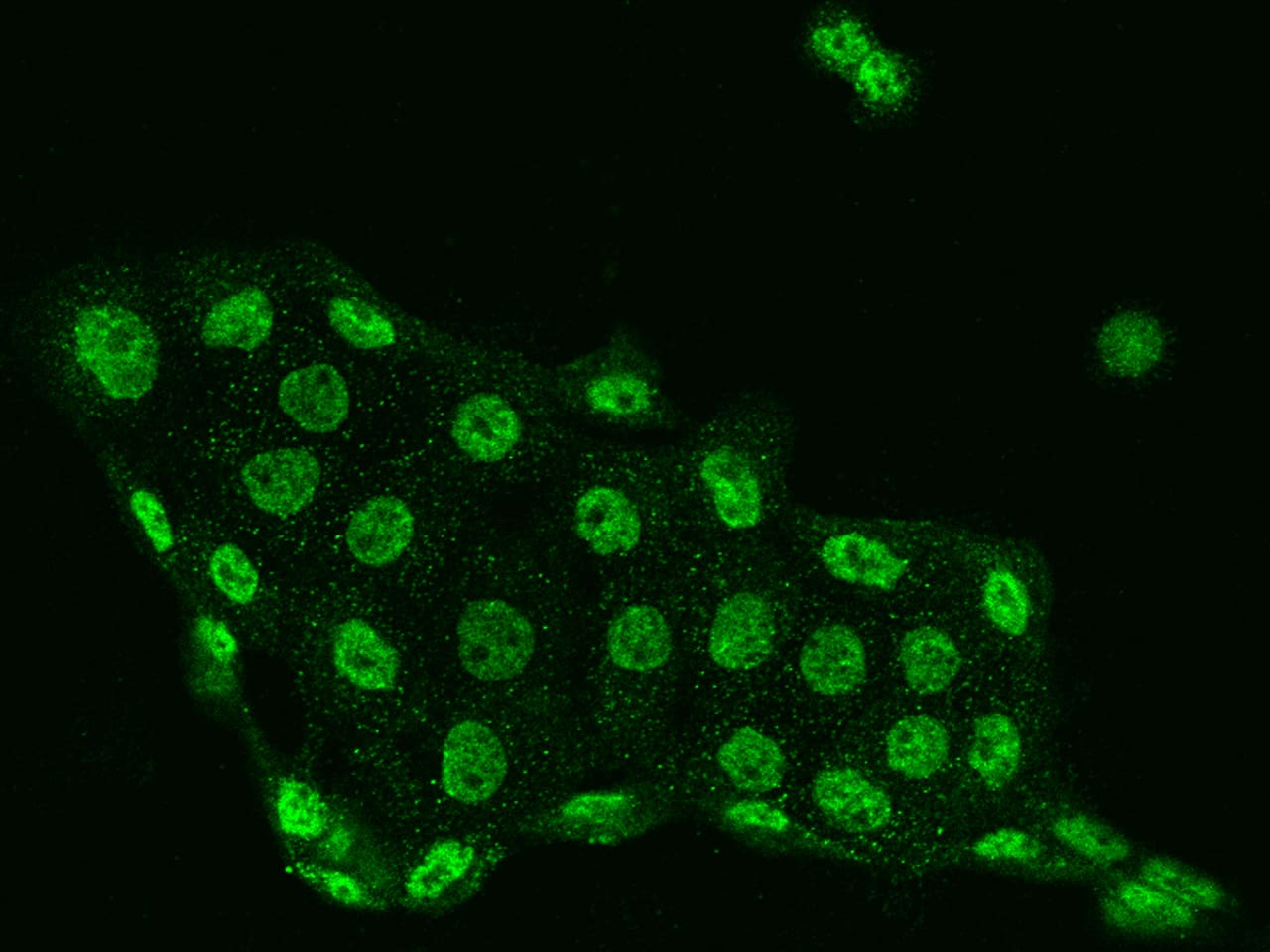 Immunocytochemistry/Immunofluorescence: DGK-iota Antibody [NBP3-06558] - Staining of DGKI in A431 cells. Cells were fixed with 4% PFA, permeabilzed with 0.3% Triton X-100 in PBS,blocked with 10% serum, and incubated with NBP3-06558 antibody (dilution ratio 1:200) at 4? overnight. Then cells were stained with the Alexa Fluor488-conjugated Goat Anti-rabbit IgG secondary antibody (green). Positive staining was localized to Nucleus.