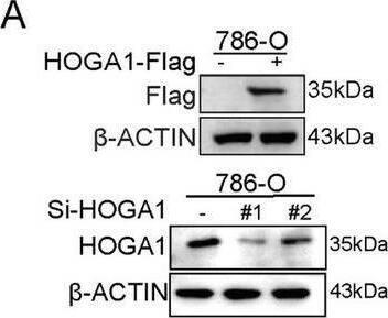 HOGA1 inhibits cell proliferation and migration in ccRCC cells. (A) Western blot validated the expression of HOGA1 and HOGA1 siRNA transfection in 786‐O cells. (B‐C) CCK‐8 assay was performed to examine the effect of HOGA1 overexpression and HOGA1 knockdown on cell viability in 786‐O cells. (D) Wound‐healing assay determined the migratory distances of HOGA1 overexpression and control. Scale bars, 10 μm. (E) The effect of HOGA1 overexpression on cell migration and invasion was evaluated by transwell assay. Scale bars, 200 μm. (F) Wound‐healing assay determined the migratory distances of HOGA1 knockdown and control. Scale bars, 10 μm. (G) The effect of HOGA1 knockdown on cell migration and invasion was evaluated by transwell assay. Scale bars, 200 μm. *p < 0.05, **p < 0.01 and ***p < 0.001. Image collected and cropped by CiteAb from the following open publication (//pubmed.ncbi.nlm.nih.gov/40100076), licensed under a CC-BY license. Not internally tested by Novus Biologicals.
