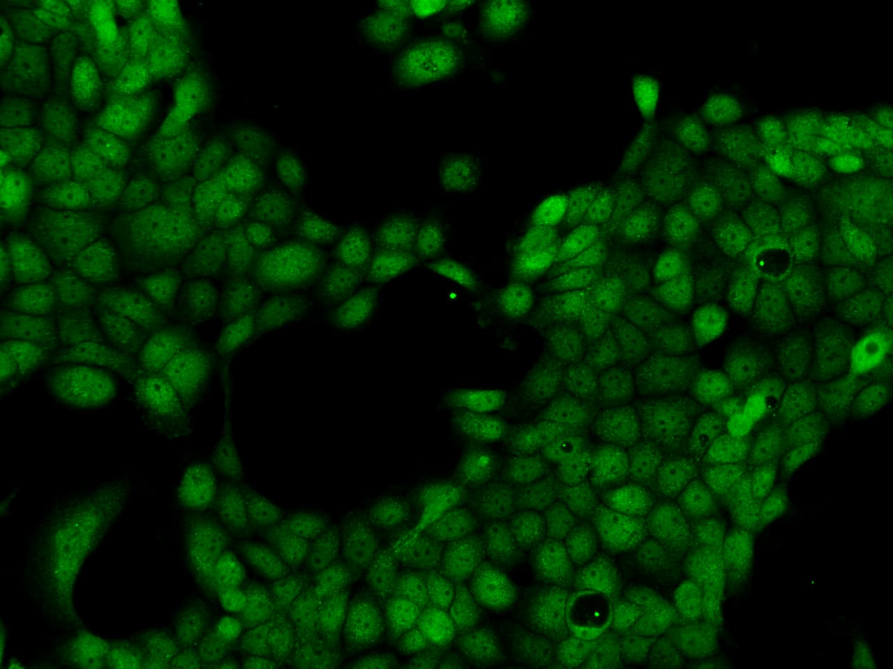 Immunocytochemistry/ Immunofluorescence LMBRD2 Antibody - BSA Free