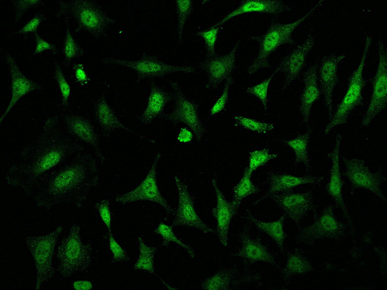 Immunocytochemistry/Immunofluorescence: TAF7L Antibody [NBP3-06642] - Immunofluorescence staining of TAF7L in Hela cells. Cells were fixed with 4% PFA, permeabilzed with 0.1% Triton X-100 in PBS, blocked with 10% serum, and incubated with NBP3-06642 (dilution ratio 1:200) at 4C overnight. Then cells were stained with the Alexa Fluor488-conjugated Goat Anti-rabbit IgG secondary antibody (green). Positive staining was localized to Nucleus and Cytoplasm.
