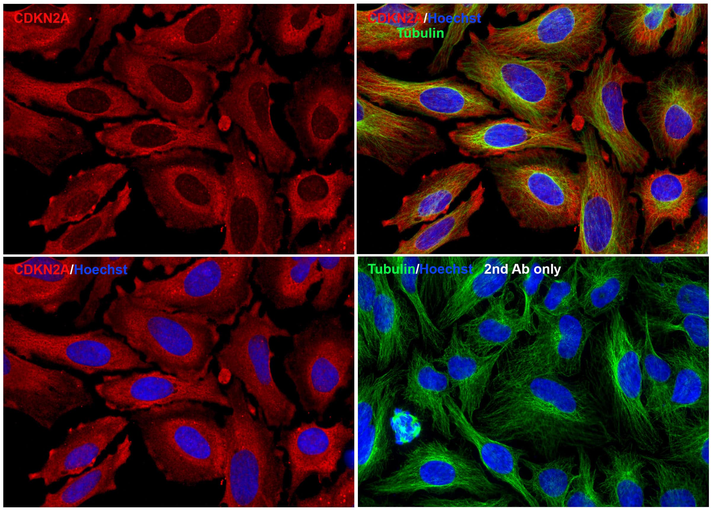 Immunocytochemistry/ Immunofluorescence: p16INK4a/CDKN2A Antibody - BSA Free [NBP3-06986] - Validation of p16INK4a/CDKN2A In HeLa Cells. Immunofluorescent analysis of methanol-fixed HeLa cells labeling p16INK4a/CDKN2A with  at 20 ug/mL, followed by goat anti-rabbit IgG secondary antibody at 1/1000 dilution (red) and Hoechst staining (blue). Alpha tubulin was stained with anti-alpha tubulin antibody following by goat anti-mouse IgG secondary antibody (green). Images were captured with confocal microscopy.  