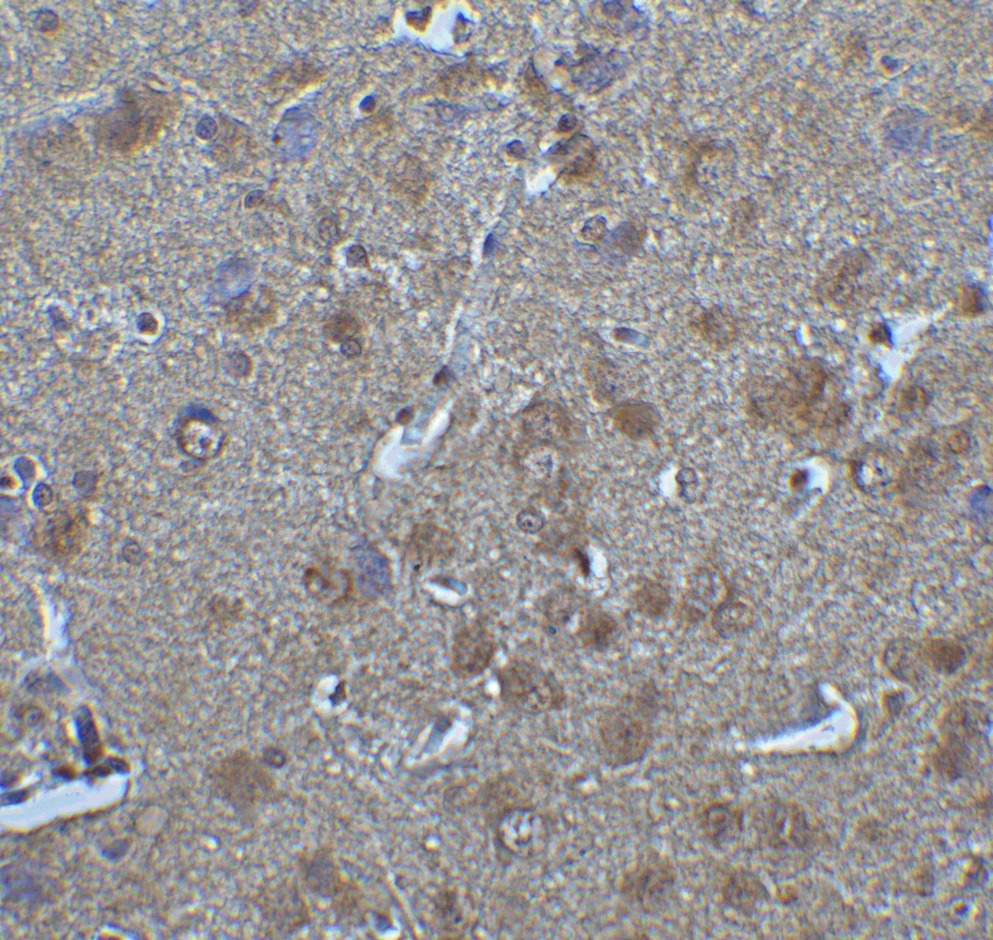 Immunohistochemistry: IRF7 Antibody - BSA Free [NBP3-06987] - Validation of IRF7 in Rat Brain Tissue.Immunohistochemical analysis of paraffin-embedded rat brain tissue using anti-IRF7 antibody  at 5 u/ml. Tissue was fixed with formaldehyde and blocked with 10% serum for 1 h at RT; antigen retrieval was by heat mediation with a citrate buffer (pH6). Samples were incubated with primary antibody overnight at 4C. A goat anti-rabbit IgG H&L (HRP) at 1/250 was used as secondary. Counter stained with Hematoxylin.