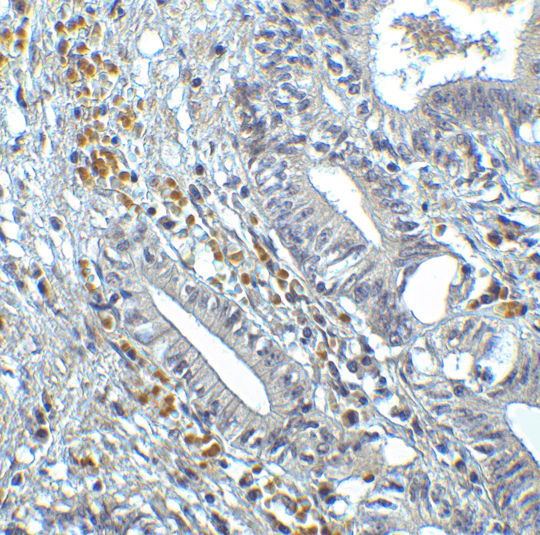 Immunohistochemistry: IRF7 Antibody - BSA Free [NBP3-06987] - Validation of IRF7 in Human Colon Tissue.Immunohistochemical analysis of paraffin-embedded human colon tissue using anti-IRF7 antibody  at 2 ug/ml. Tissue was fixed with formaldehyde and blocked with 10% serum for 1 h at RT; antigen retrieval was by heat mediation with a citrate buffer (pH6). Samples were incubated with primary antibody overnight at 4C. A goat anti-rabbit IgG H&L (HRP) at 1/250 was used as secondary. Counter stained with Hematoxylin.