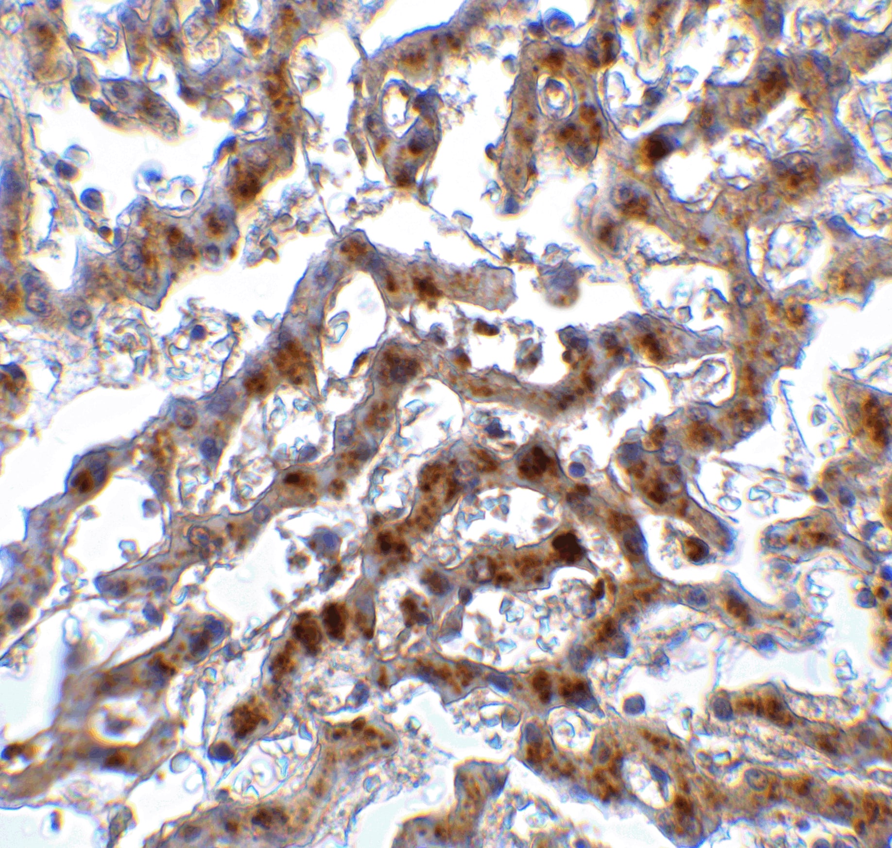 Immunohistochemistry: IRF7 Antibody - BSA Free [NBP3-06987] - Validation of IRF7 in Human Liver Tissue.Immunohistochemical analysis of paraffin-embedded human liver tissue using anti-IRF7 antibody  at 2 ug/ml. Tissue was fixed with formaldehyde and blocked with 10% serum for 1 h at RT; antigen retrieval was by heat mediation with a citrate buffer (pH6). Samples were incubated with primary antibody overnight at 4C. A goat anti-rabbit IgG H&L (HRP) at 1/250 was used as secondary. Counter stained with Hematoxylin.